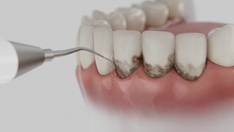 Reliable Dental Implants contractor in Como, MS by Smile Center Dentistry
